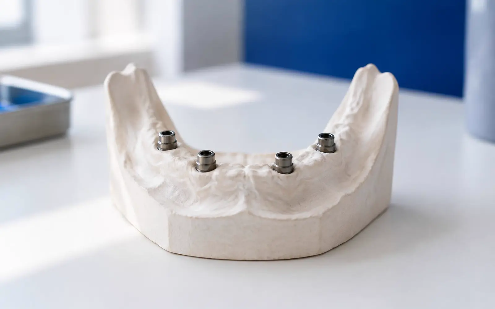 Gipsen model van een tandeloze onderkaak met vier metalen implantaatposities